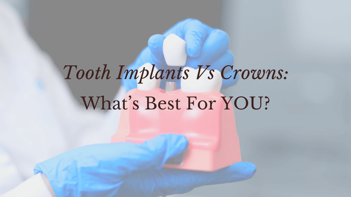 Tooth Implants Vs Crowns_ What’s Best For YOU