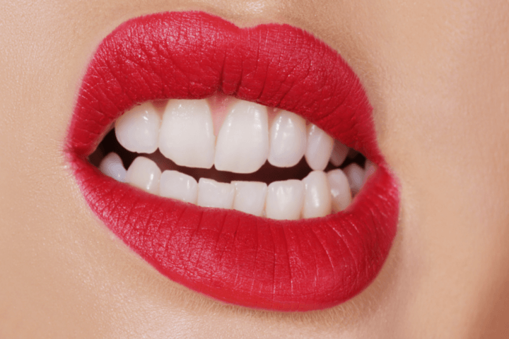 7 Habits That Cause Bad Teeth