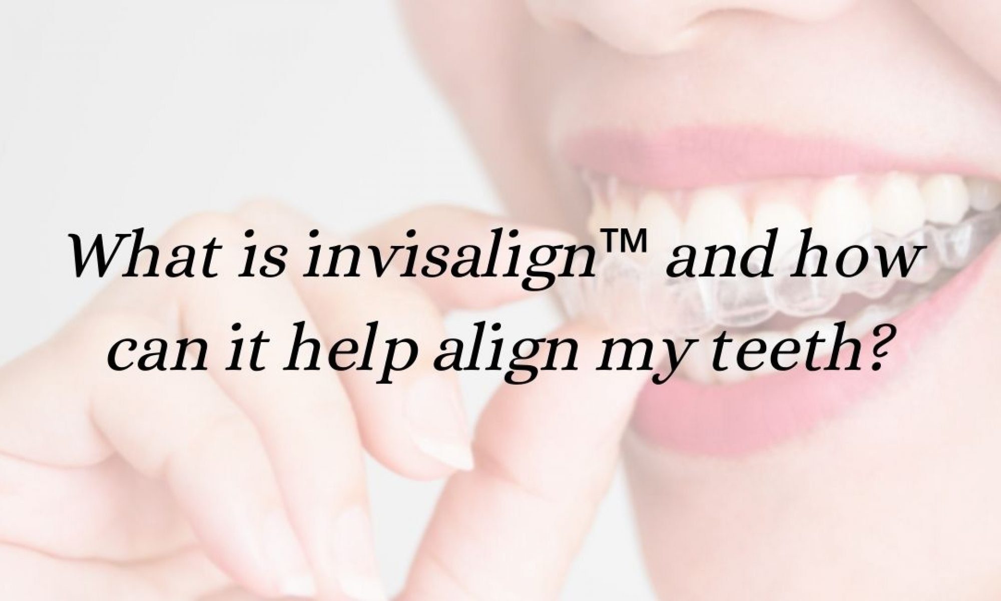 What is invisalign