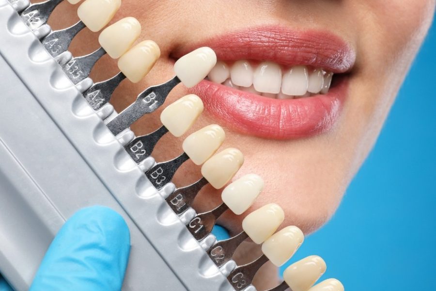 Cosmetic Dentistry