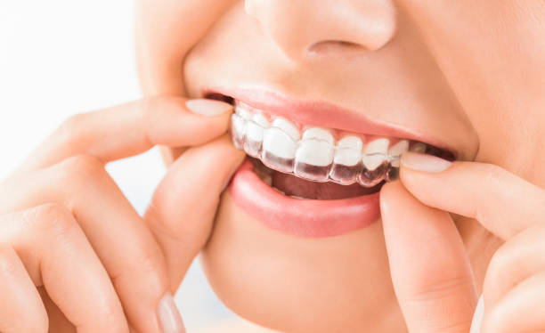 Orthodontic Treatment