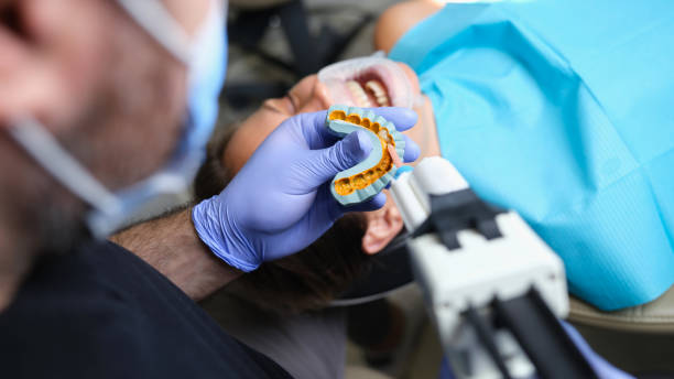 Dental Sealants process