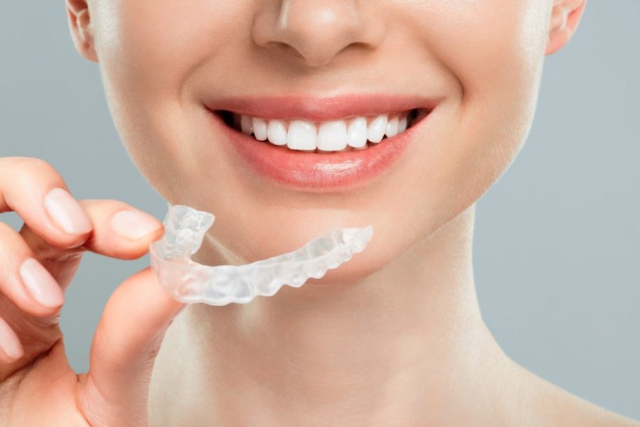 invisalign 2