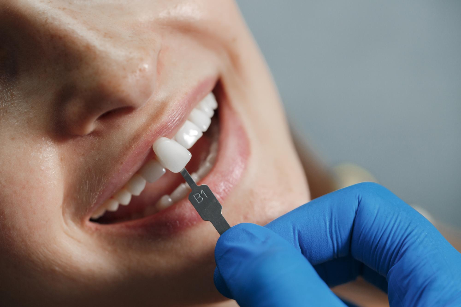 When and Why Dental Crowns are Necessary